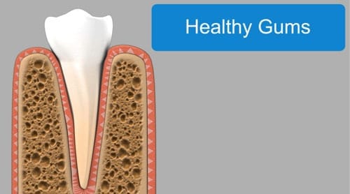 Infographic on health gums